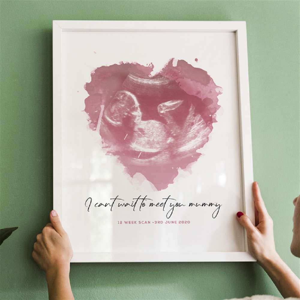 Personalised Baby Scan Print