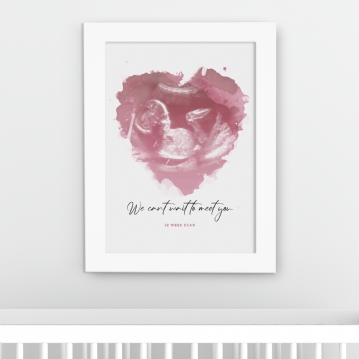 Personalised Baby Scan Print