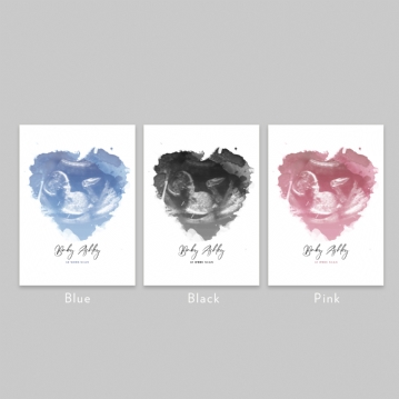 Personalised Baby Scan Print