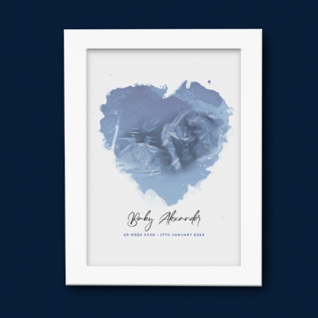 Personalised Baby Scan Print