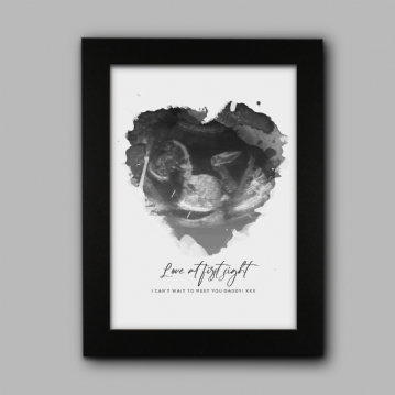 Personalised Baby Scan Print