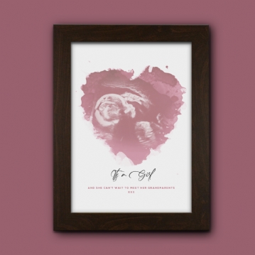 Personalised Baby Scan Print