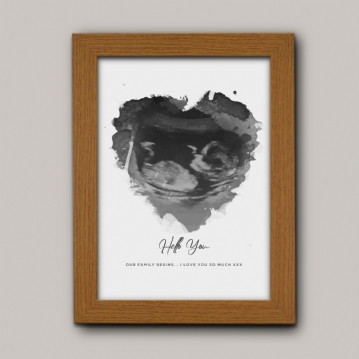 Personalised Baby Scan Print