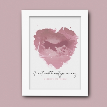 Personalised Baby Scan Print